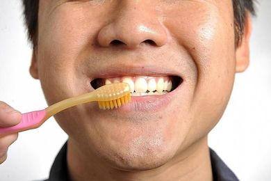 Smile: There are many options for whiter teeth