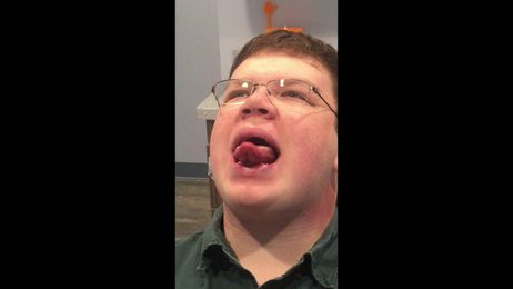 Myofuctional Therapy Techniques To Try At Home!