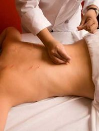 5 Things To Look for in An Acupuncture Clinic