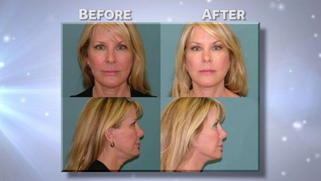 New Year New You! from Estetica Institute of the Palm Beaches