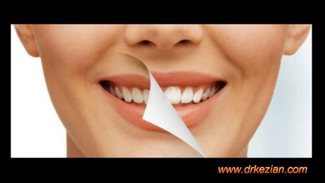 Professional Teeth Whitening Services