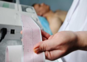 The Medical Assistant's Guide to an EKG Exam and the Cardio System