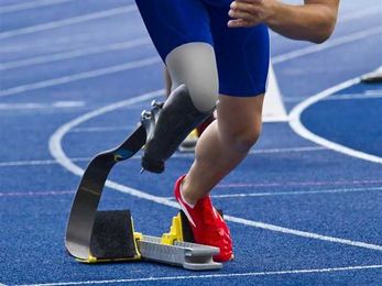 The real world of prosthetics 