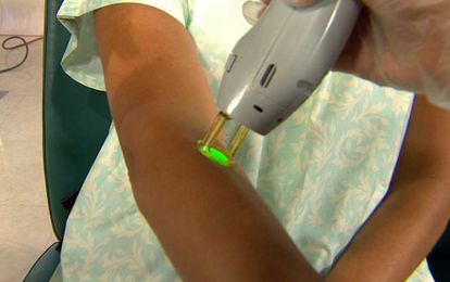 Your laser hair removal questions, answered!