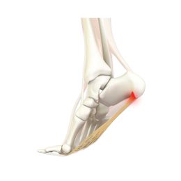 Caring for your Feet: A Conversation with an Orthopedic Surgeon