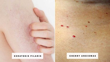 7 Reasons Your Skin Has Red Spots and Bumps