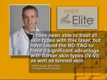 Cynosure Elite™ (PART 2)