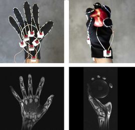 MRI glove enables imaging of moving joints