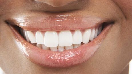 How the latest tech in dentistry can help you achieve the perfect smile