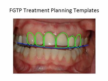 Collaborative Endodontics and Restorative Dentistry