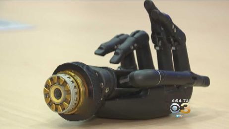 Man Buys Prosthetic Hand At Pawn Shop; Sets Out To Return It To Owner