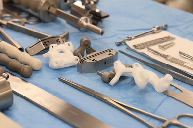 Using Patient-Specific 3D Printed Surgical Guides for Total Knee Replacement