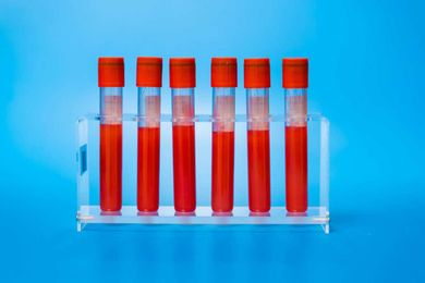 Blood Work 101: What Lab Results Really Mean