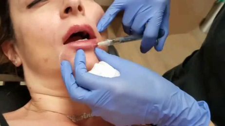 Get That Luscious Lip Plump!