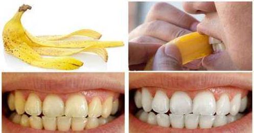 How to whiten the teeth using banana peels