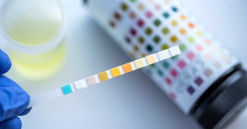 What Do You Need to Know about Pre-Employment Drug Tests?