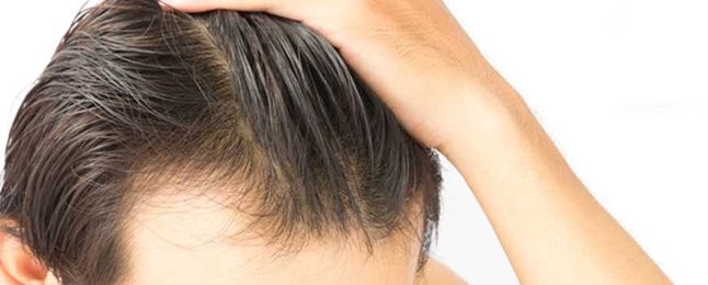What's New? New Trends in Hair Transplants