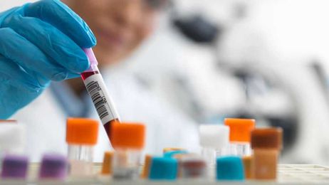 Scientists say they've developed blood test that can detect internal body clock