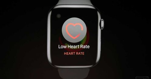 Why an Apple Watch with EKG matters