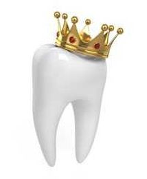 The Benefits of Dental Crowns