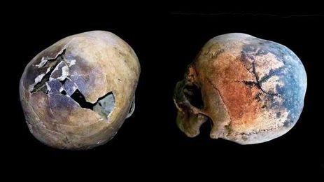 Scientists say Mount Vesuvius made people's heads explode