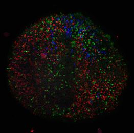Scientists grow tiny human retinas in a dish