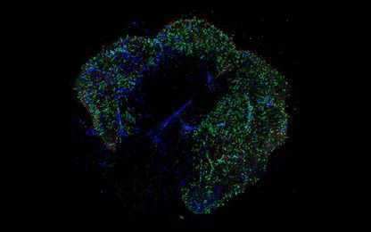 Lab-Grown 'Mini-Eyes' Show How Color Vision Develops