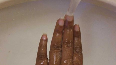 Drs. Rx: Helpful Hacks with Bar Soap!