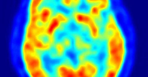 Researches identify features least-sensitive to PET system variations