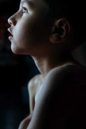Experts chase the cause of a paralyzing childhood disease spiking this year