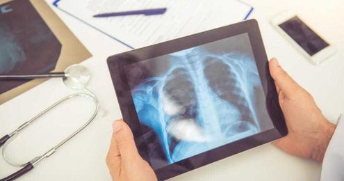 Radiologists inconsistent with how they convey diagnostic certainty