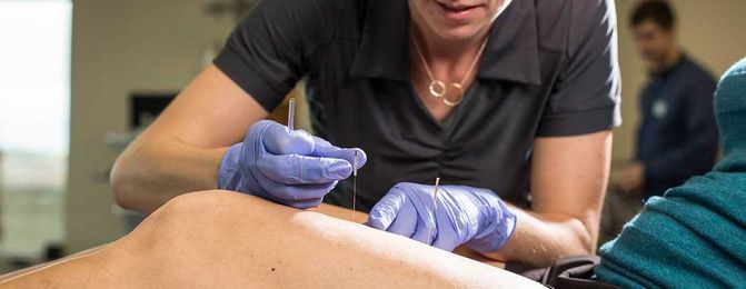 To Stop Pain, Try Acupuncture or Dry Needling