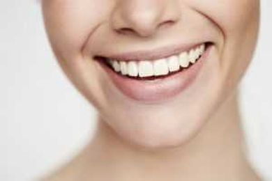 Why You Should Consider Dental Bonding