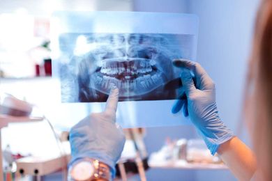 The Importance of Dental X-Rays