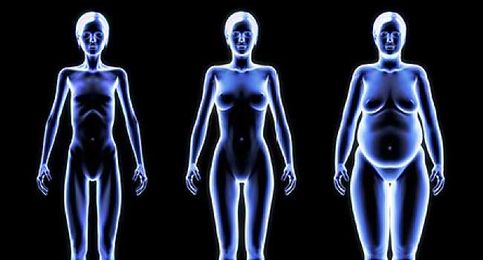 Slideshow: What Your Body Shape Says About Your Health