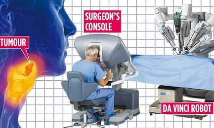 Throat cancer tumours can now be cut out by a robot