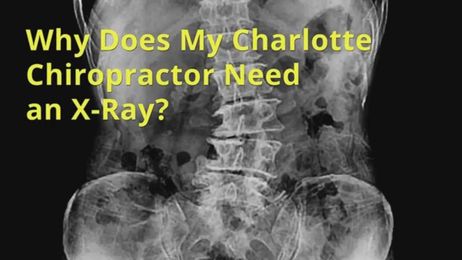 Why Does The Best Charlotte Chiropractor Near Me Need X rays?