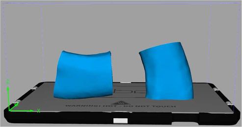 Researchers Evaluate 3D Printed Mandibular Grafts for Effectiveness as Implants