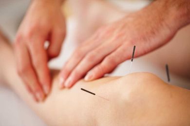 What Is Acupuncture? What Are the Benefits?