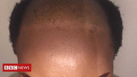 Could your hairstyle be causing hair loss?