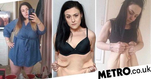 Woman is raising £12,000 to remove excess skin after losing half her body weight