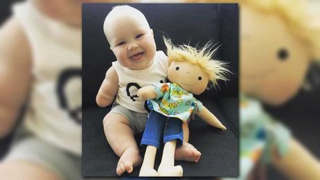 Dolls with scars, missing limbs bring joy to kids with medical conditions