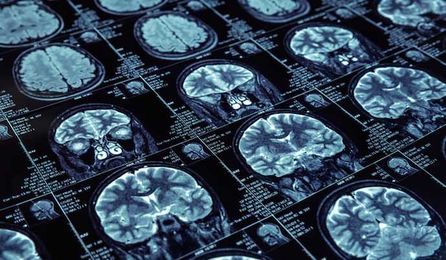 Top 4 Ways to Advance Artificial Intelligence in Medical Imaging