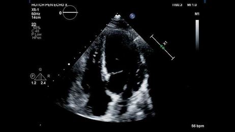 Analyze This Image: What Is Being Shown Here?