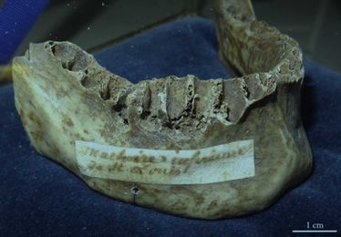 Scientists Find Scurvy in Mouth of Long-Dead, Failed Crusader King