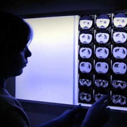 Female radiologists read fewer advanced imaging studies