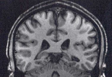 Brain-eating amoeba kills swimmer at NC water park