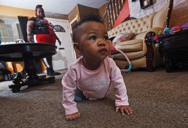 3D-printed organs help doctors picture what awaits them in surgery