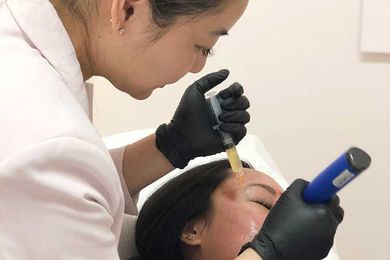 Oxygen and Vampire Facials as Alternative Skin Care Treatments