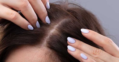 Getting to the Root of Hair Loss